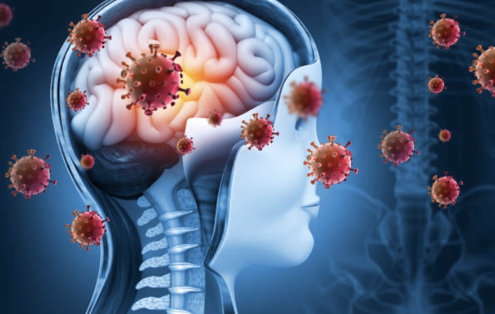 Negligencias médicas en Meningitis