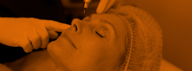 Apelación malpraxis lifting facial