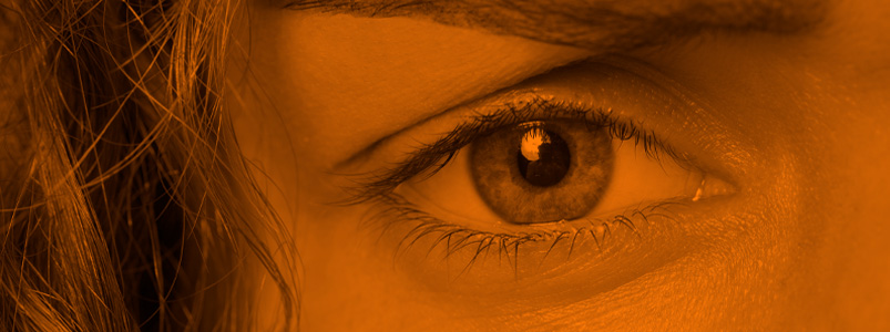 Complicaciones en cirugía LASIK