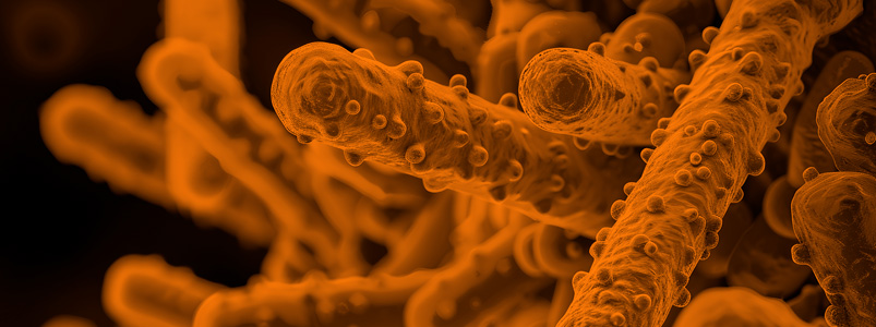 Infección hospitalaria por Pseudomona aeruginosa