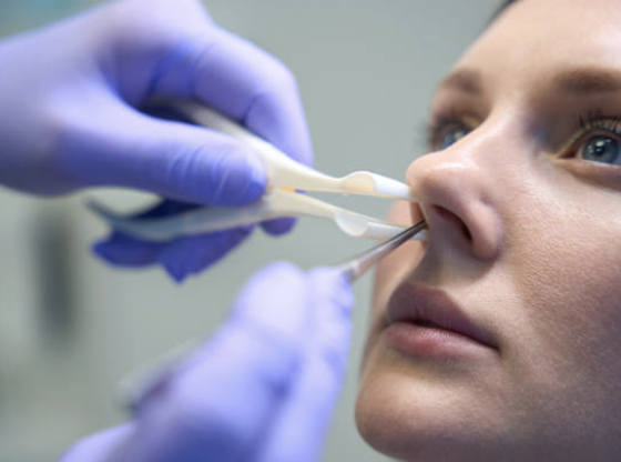 Negligencia médica en cesárea y anexectomía